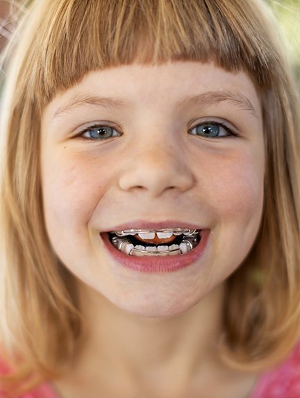 Young girl wearing retainer 